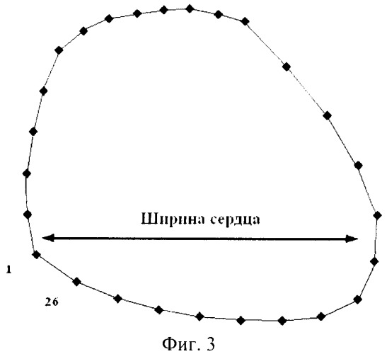 Способ определения контура сердца на флюорографических снимках (патент 2478337)