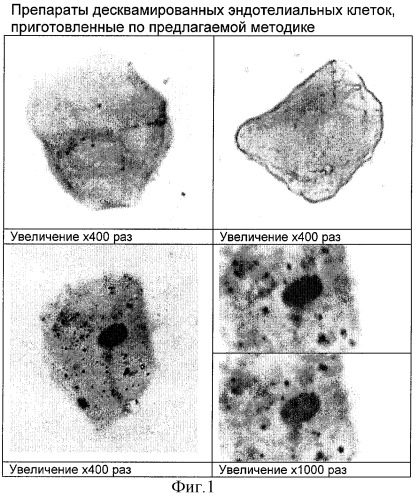 Способ приготовления препаратов десквамированных эндотелиальных клеток периферической крови (патент 2309752)