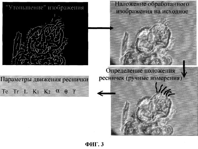 Способ выбора тактики лечения хронического и острого риносинусита (патент 2254805)