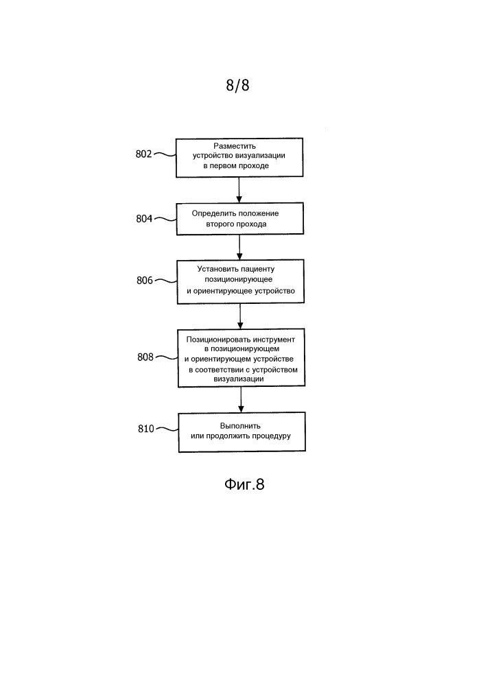 Индивидуализированное для пациента позиционирование и ориентирование хирургических инструментов при размещении проходов (патент 2662872)