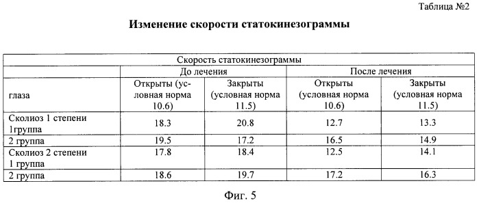 Способ лечения сочетанной деформации таза и позвоночника у детей и устройство для его осуществления (патент 2448667)