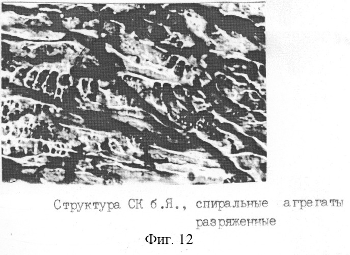 Способ экспресс-диагностики гипер-бета 2-микроглобулинемии (патент 2259565)