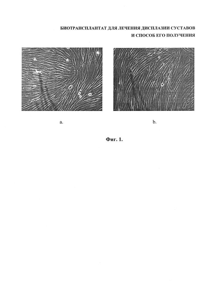 Биотрансплантат для лечения дисплазии суставов и способ его получения (патент 2659204)