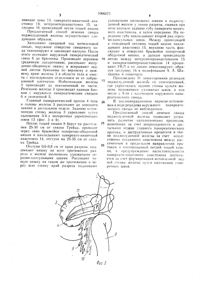 Способ лечения свища поджелудочной железы (патент 1066571)
