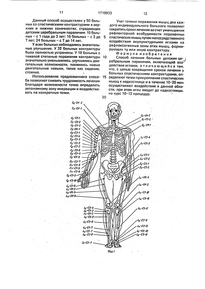 Способ лечения больных детским церебральным параличем (патент 1718933)