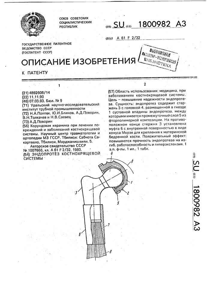 Эндопротез костнохрящевой системы (патент 1800982)