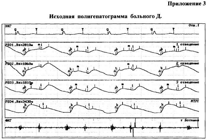 Способ и устройство для оценки гемодинамики печени (патент 2372022)