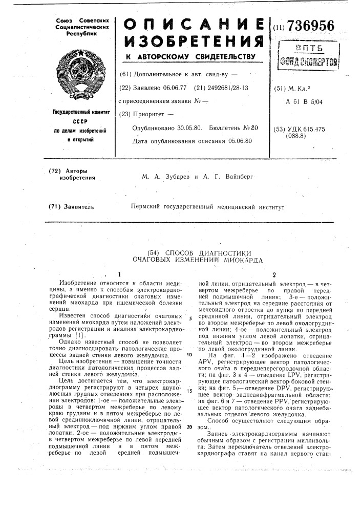 Способ диагностики очаговых изменений миокарда (патент 736956)