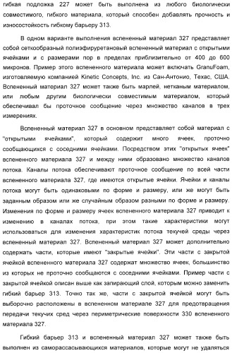 Устройство для лечения путем подкожной подачи пониженного давления с использованием разделения с помощью воздушного баллона (патент 2401652)