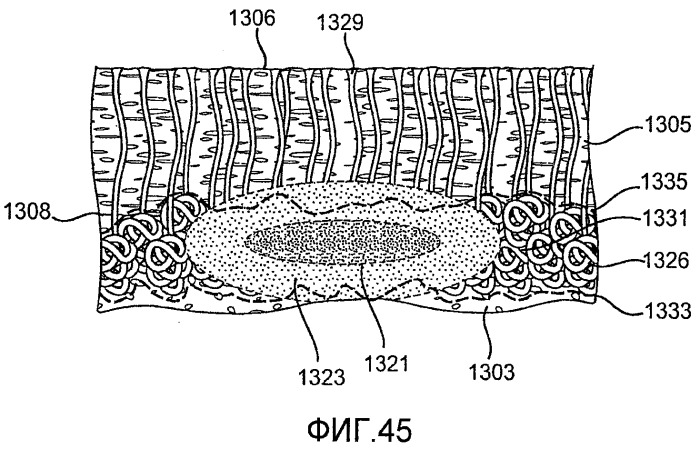Системы и способы создания воздействия на заданную ткань с использованием микроволновой энергии (патент 2523620)