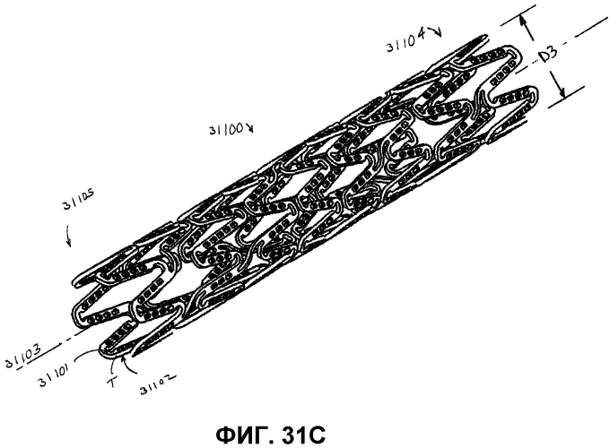 Стент из оголенного металла с резервуарами, выделяющими лекарственные препараты (патент 2573107)