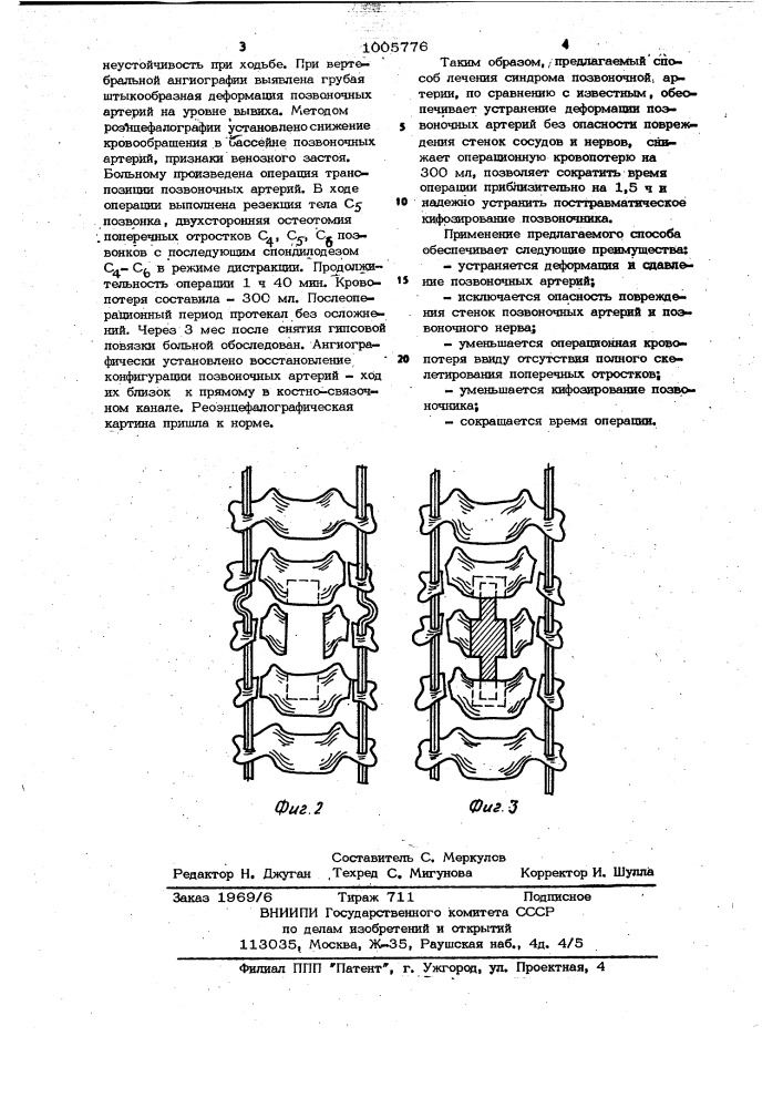 Способ лечения синдрома позвоночной артерии при застарелых вывихах шейных позвонков (патент 1005776)