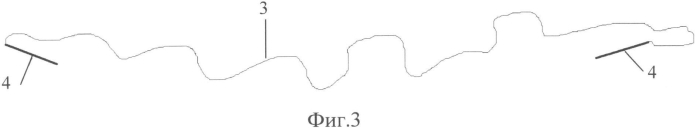 Способ и устройство для формирования хирургических анастомозов (патент 2574132)