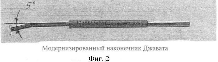 Способ восстановления дакриоцисториностомы в случае ее заращения (патент 2428150)