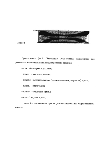 Устройство анализа бронхофонограмм (патент 2574713)