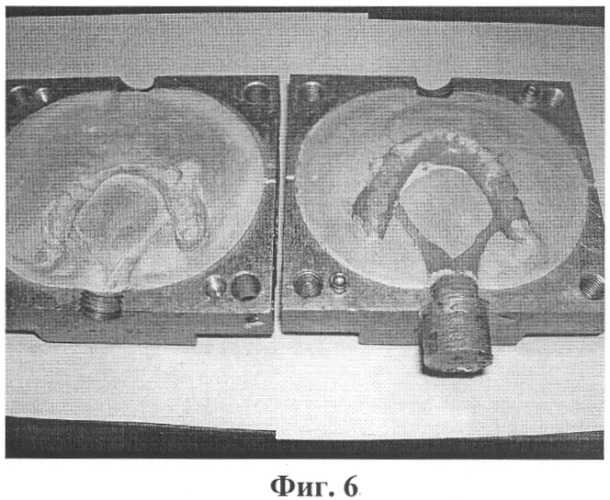 Способ изготовления съемных ортопедических конструкций методом инжекционного литья с использованием дополнительных каналов (патент 2320291)