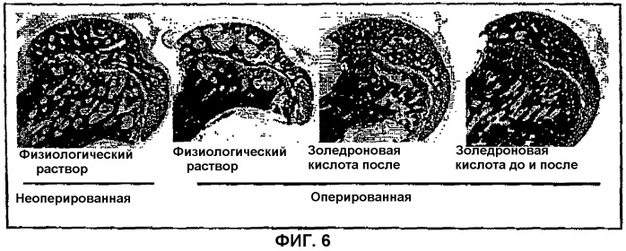 Лекарственное средство для лечения остеонекроза и для лечения пациентов с риском развития остеонекроза (патент 2284821)