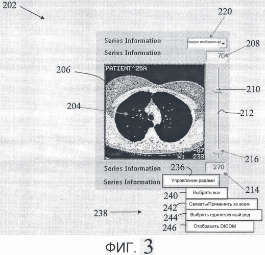 Управление сериями для менеджера архива медицинских изображений, вызывающее коренные изменения (патент 2420234)