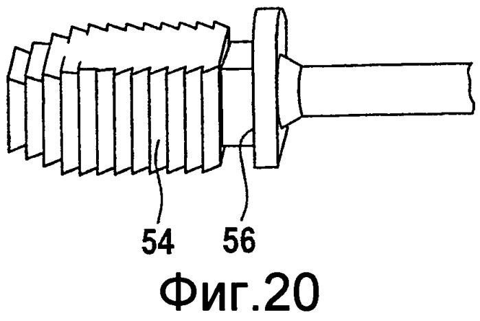 Межпозвонковый шарнирный протез для шейного отдела позвоночника (патент 2325875)