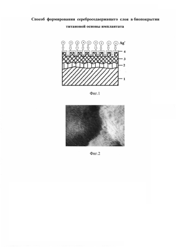 Способ формирования серебросодержащего биопокрытия титанового имплантата (патент 2581825)