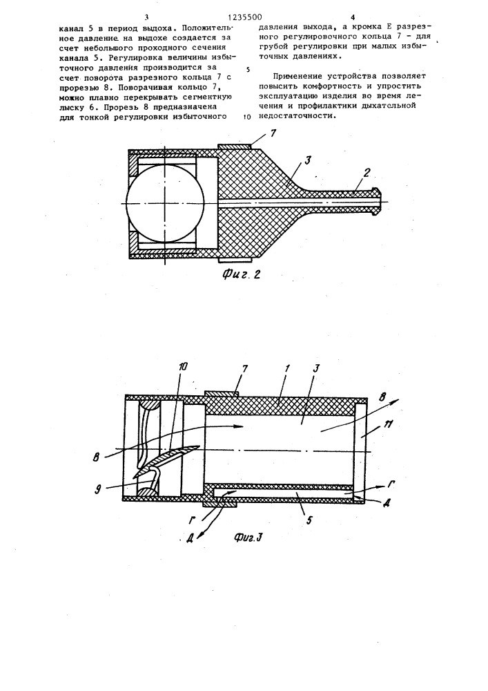 Устройство для лечения дыхательной недостаточности (патент 1235500)