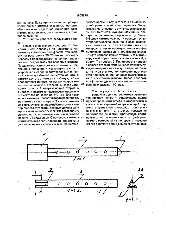 Устройство для остеосинтеза фрагментов нижней челюсти (патент 1805928)
