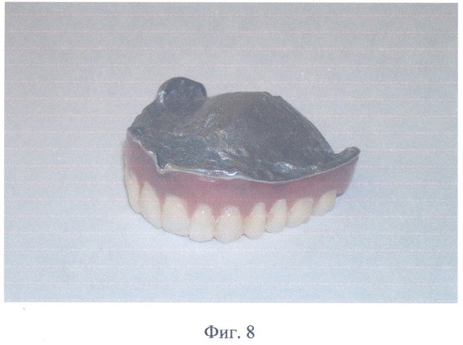 Полный съемный зубной протез верхней челюсти (патент 2314773)