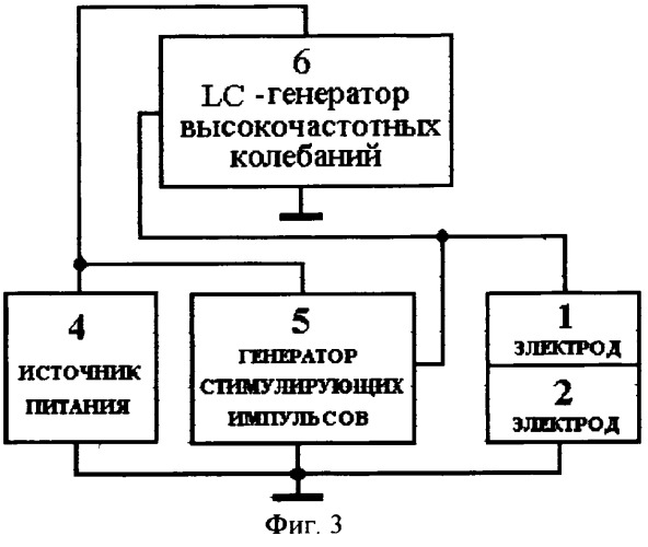 Электростимулятор желудочно-кишечного тракта (патент 2264236)