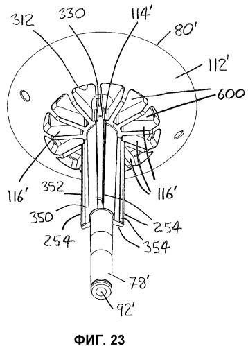 Газоочистной сепаратор (патент 2492935)