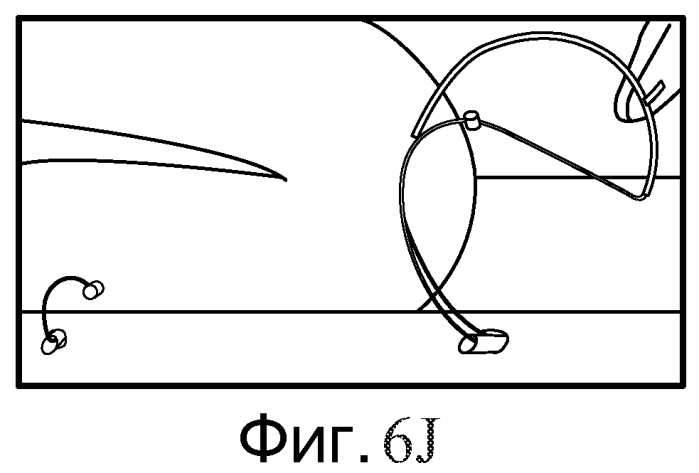 Способ и устройство для сближения ткани (патент 2573183)