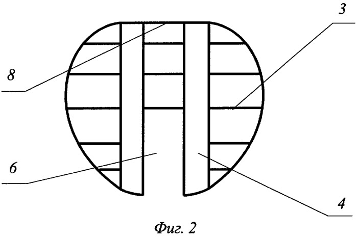 Имплантат межпозвонкового диска поясничного отдела (патент 2281731)