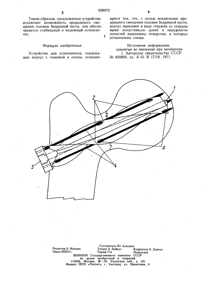 Устройство для остеосинтеза (патент 938973)