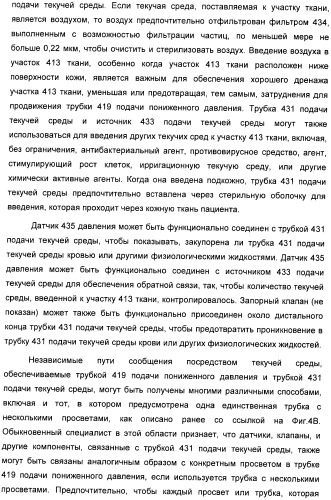 Способ лечения путем подкожной подачи пониженного давления с использованием разделения с помощью воздушного баллона (патент 2405588)