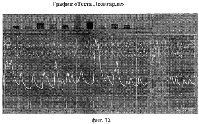 Способ диагностики нарушений сексуальных предпочтений (патент 2283029)