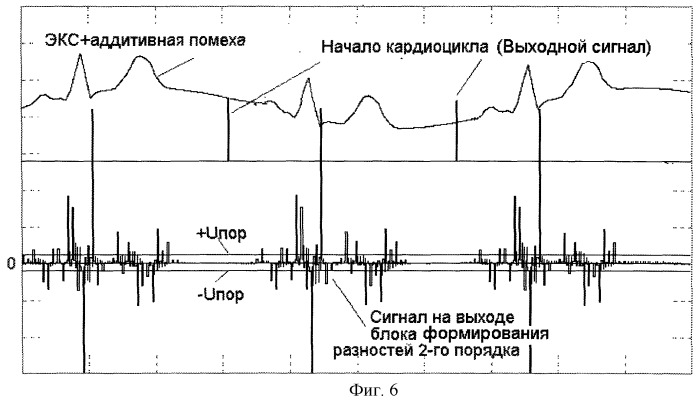 Способ устранения дрейфа изолинии электрокардиосигнала и устройство для его осуществления (патент 2251968)