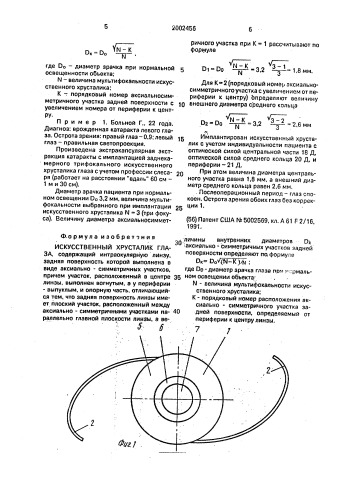 Искусственный хрусталик глаза (патент 2002456)