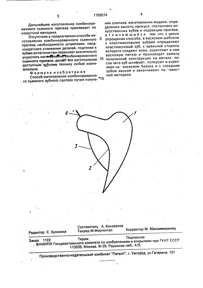 Способ изготовления комбинированного съемного зубного протеза (патент 1799574)