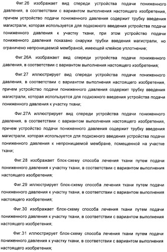 Система и способ продувки устройства пониженного давления во время лечения путем подачи пониженного давления (патент 2404822)