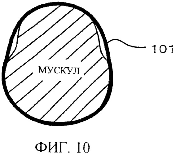 Устройство для укрепления мускулов (патент 2350371)