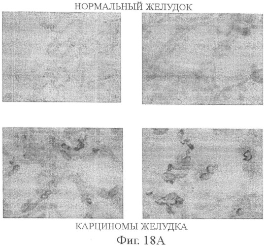 Моноклональные антитела к клаудину-18 для лечения рака (патент 2445319)