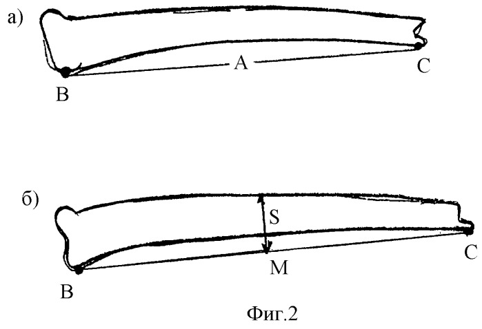 Способ определения длины штифта при внутрикостном остеосинтезе и линейка для этого (патент 2275853)
