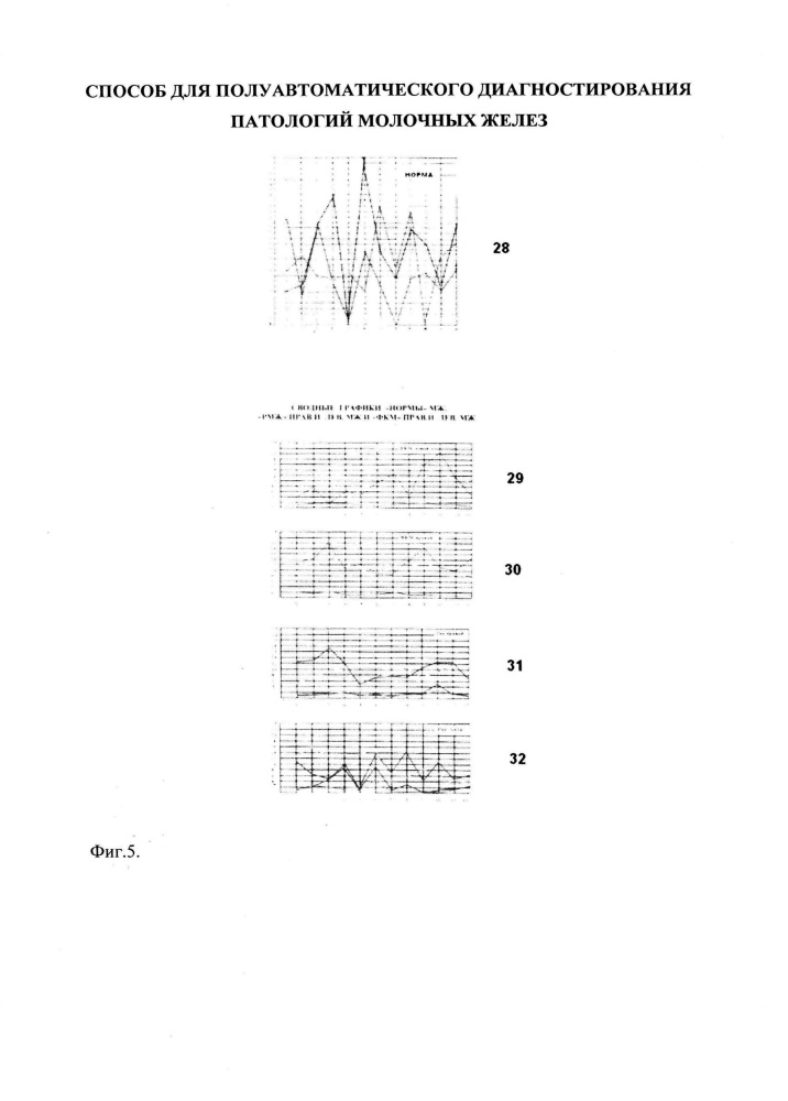 Способ для полуавтоматического диагностирования патологий молочных желёз (патент 2622362)