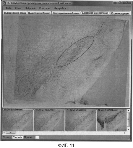 Автоматизированная система реконструкции 3d распределения нейронов по серии изображений срезов головного мозга (патент 2504012)