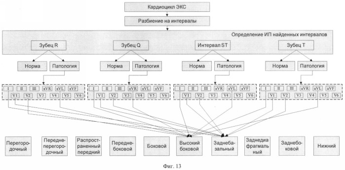 Способ обработки электрокардиосигнала для диагностики инфаркта миокарда (патент 2383295)