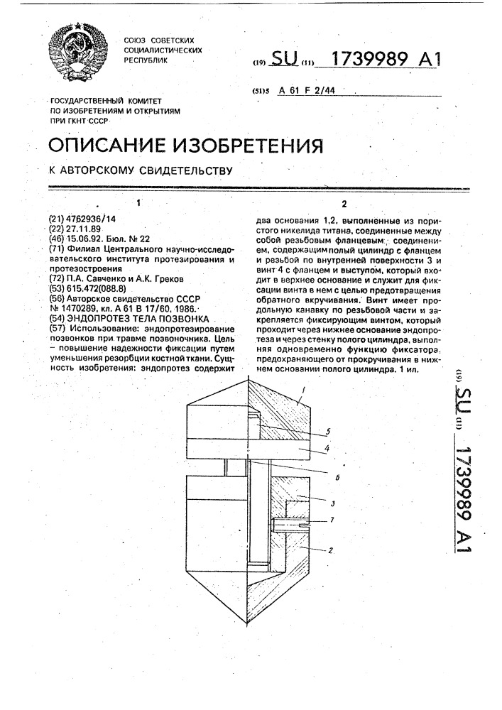 Эндопротез тела позвонка (патент 1739989)