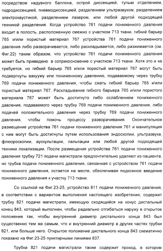 Система и способ продувки устройства пониженного давления во время лечения путем подачи пониженного давления (патент 2404822)