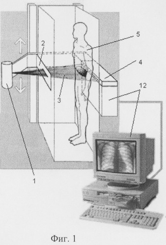 Рентгенографическая установка сканирующего типа (варианты) (патент 2257639)