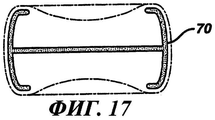 Составная гигиеническая прокладка (варианты) (патент 2253426)