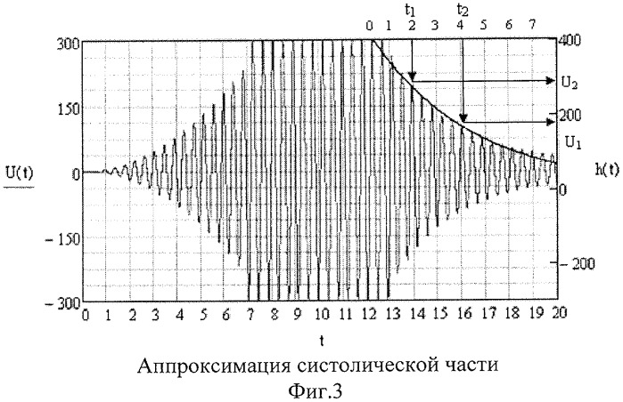 Способ измерения артериального давления (патент 2441581)