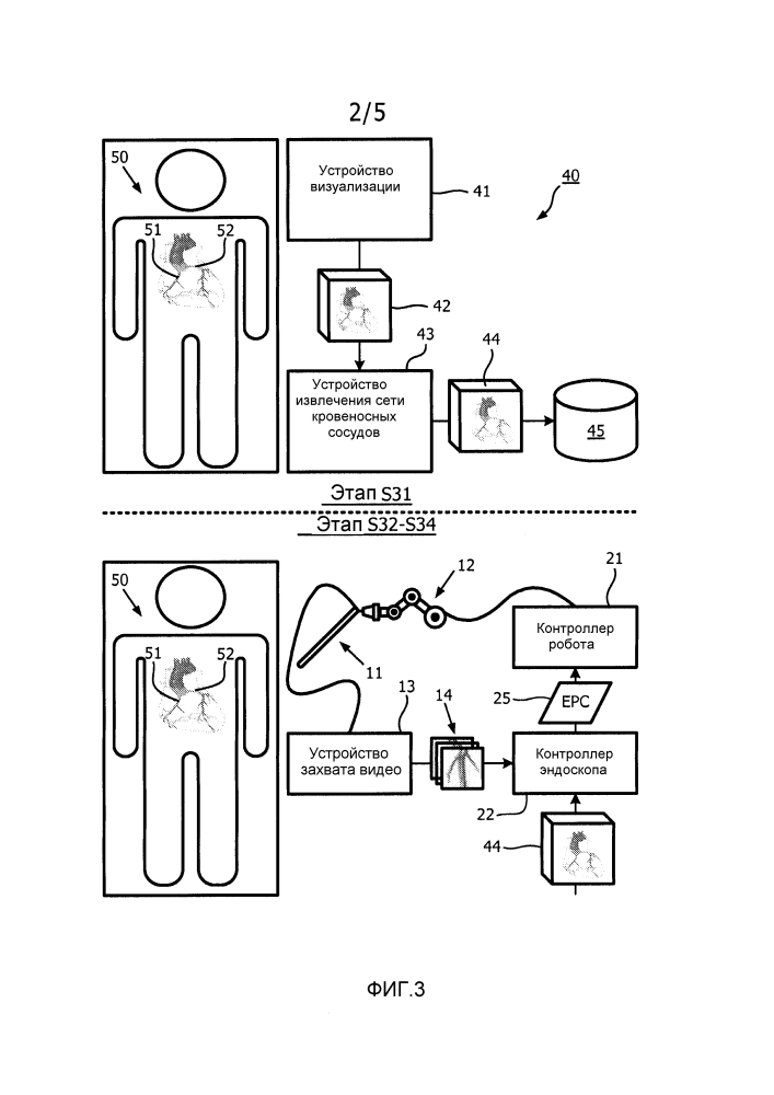 Роботизированное управление эндоскопом по изображениям сети кровеносных сосудов (патент 2594813)
